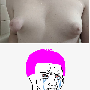 transbreast_0.png