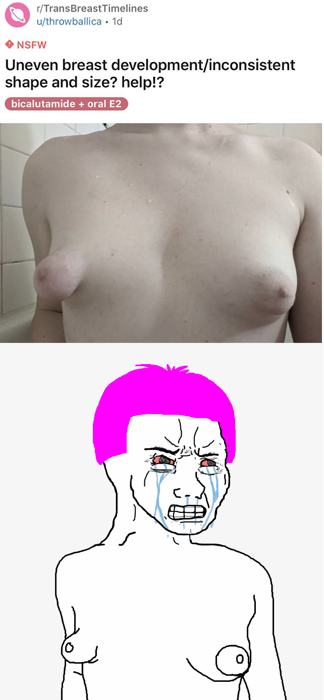 transbreast_0.png